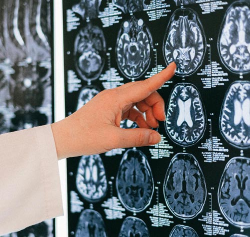 avaliação neuropsicológica em piracicaba